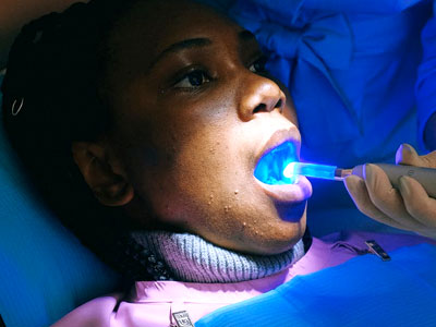 Odontologo en Maturin Blanqueamiento Dental